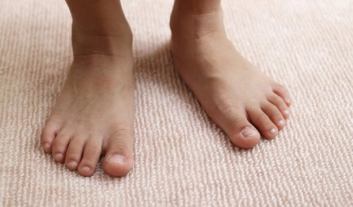 تشخیص کف پای صاف در کودکان