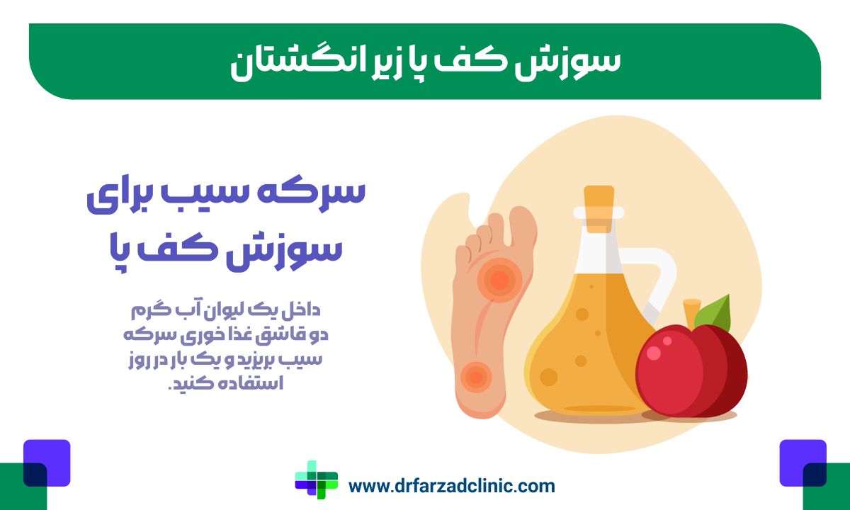 سرکه سیب برای سوزش کف پا
