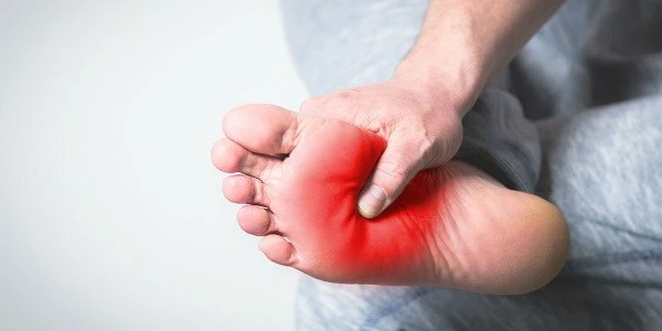 Pain-burning-soles-feet
