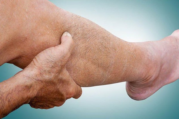 راه‌هایی برای درمان گرفتگی عضله پشت ساق پا