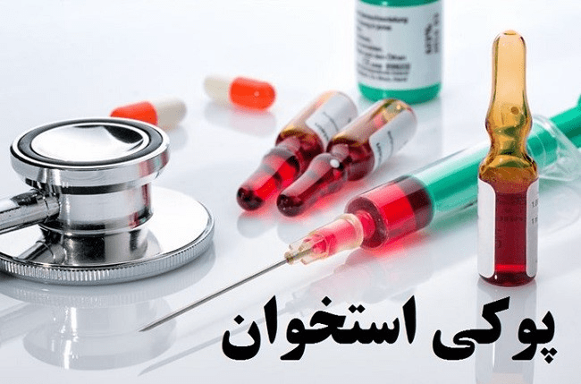 جدیدترین درمان پوکی استخوان چیست؟